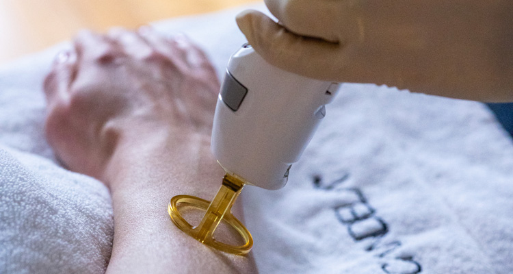 Depilação Laser Alexandrite